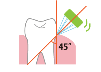 歯ブラシは歯面に45度くらいの角度で