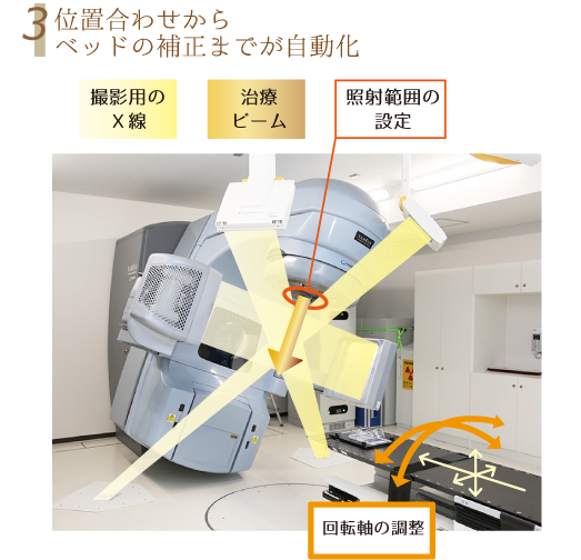 3. 位置合わせからベッドの補正までが自動化