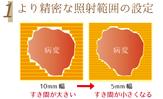 1.より精密な照射範囲の設定