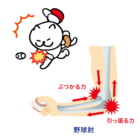 野球肘